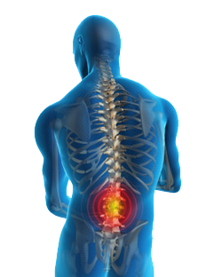 backpain backpain