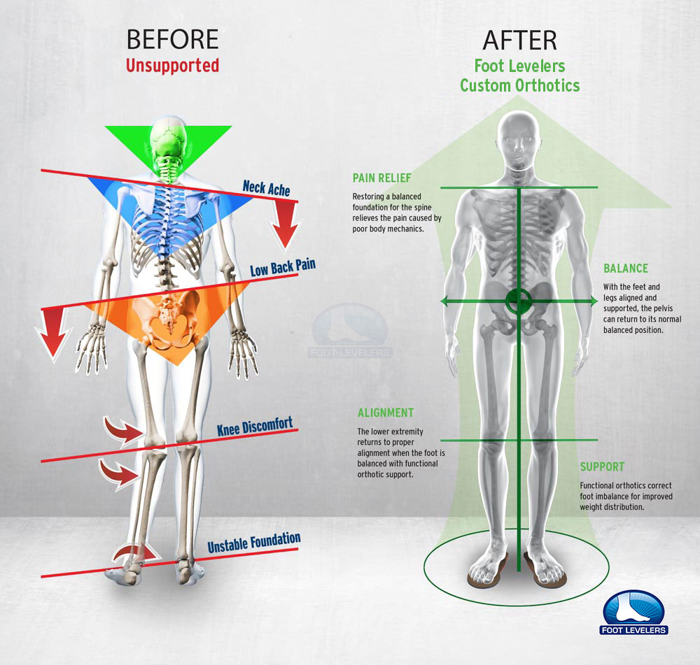 Foot Levelers chart